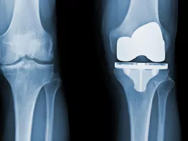 Fatigue & Corrosion [BES]