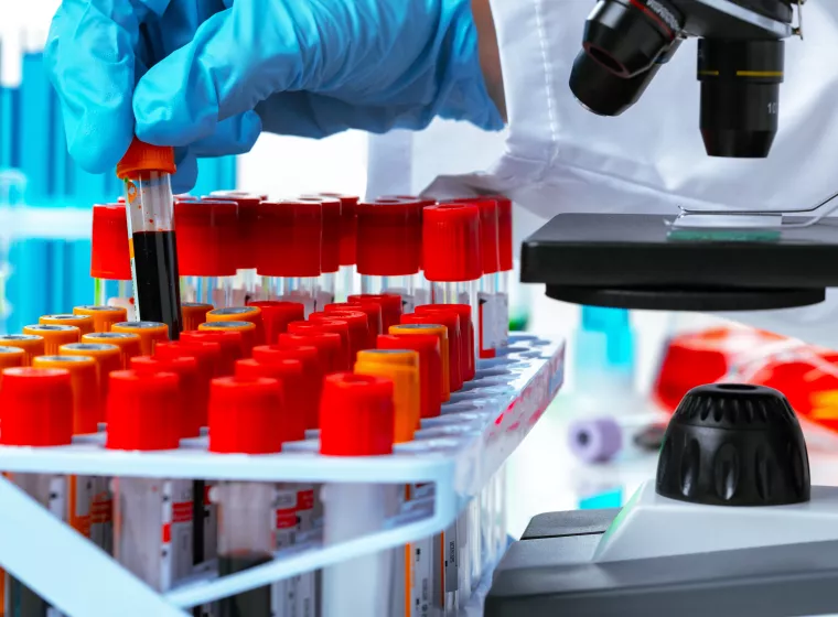 Scientist's hands doing chemical research with the help of microscope