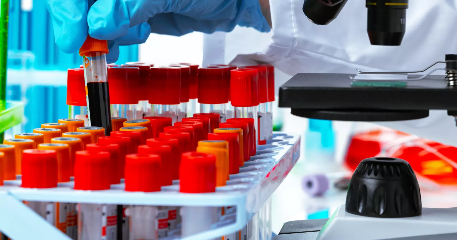 Scientist's hands doing chemical research with the help of microscope