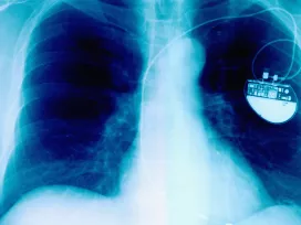 Medical Devices ​[EECS]