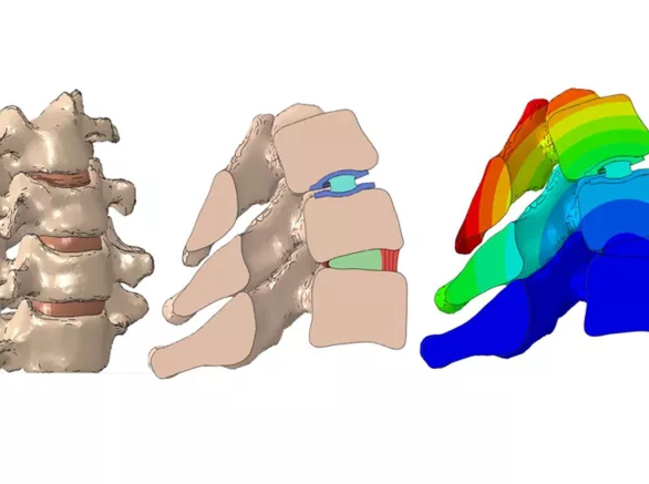 Evaluation of kinematics of a total disc replacement device