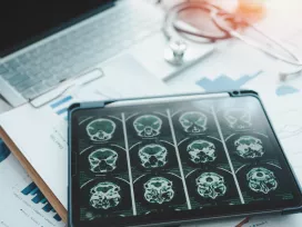 Cranial X-rays on a medical tray. Exponent examines human performance issues and behaviors in accident causation.